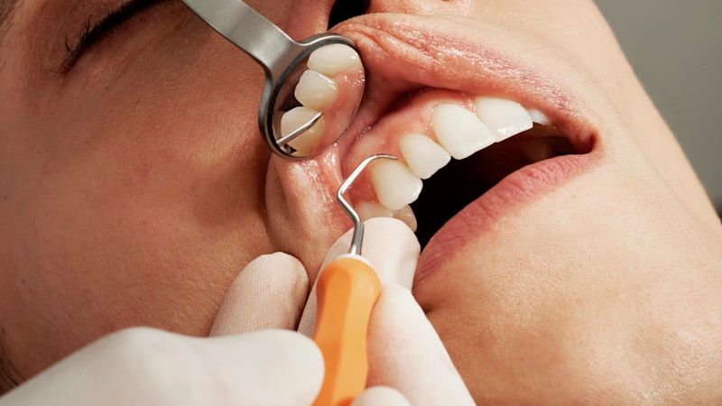 Invisalign SEO services in Khulna - professional invisalign digital marketing by Adfix Agency