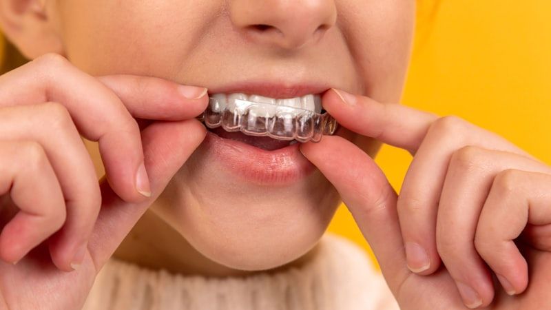 Dental Implants SEO services in Khulna - professional dental implants digital marketing by Adfix Agency